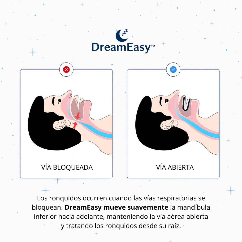 Pack 2x1 DreamEasy™ Anti-Ronquidos